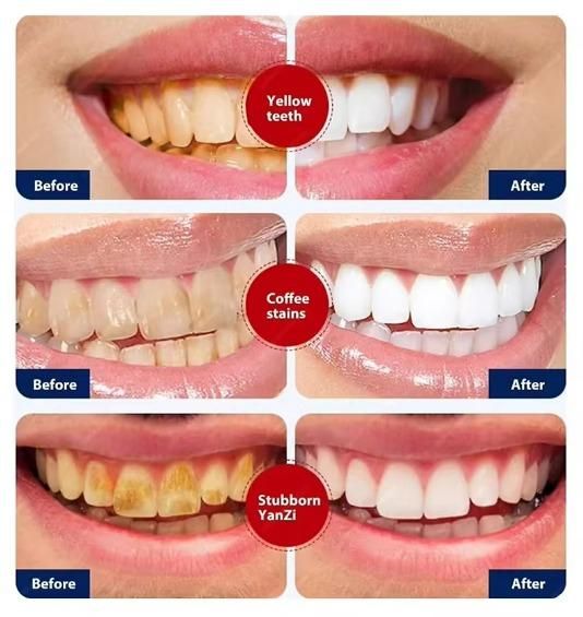 Smoke Stains White Plus Toothpaste – Pack of 2 (200g Each) | Removes Stains, Freshens Breath & Whitens Teeth