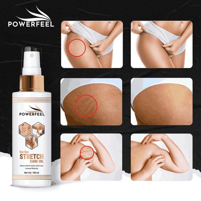 Stretch Marks Oil for Women – Nourishing Firming Formula for Body, Belly, Thighs | Reduces Stretch Marks & Uneven Skin Tone | 100ml