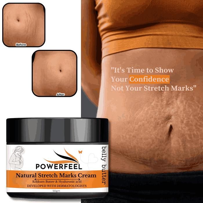 Natural Stretch Marks Cream 50g – Fades Scars, Improves Skin Elasticity & Firms Skin | Fast-Absorbing, Non-Greasy Formula