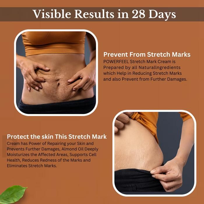 Natural Stretch Marks Cream 50g – Fades Scars, Improves Skin Elasticity & Firms Skin | Fast-Absorbing, Non-Greasy Formula