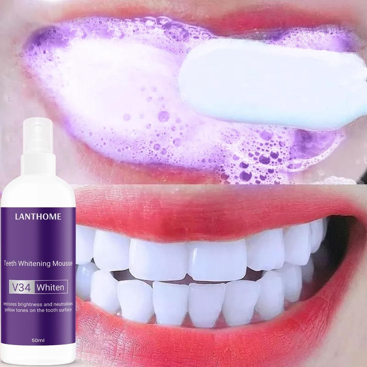 Lanthome V34 Teeth Whitening Spray Mousse – 50ml (Pack of 2) | Removes Stains, Brightens Smile & Reduces Sensitivity