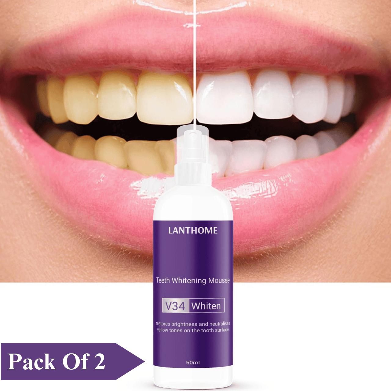 Lanthome V34 Teeth Whitening Spray Mousse – 50ml (Pack of 2) | Removes Stains, Brightens Smile & Reduces Sensitivity