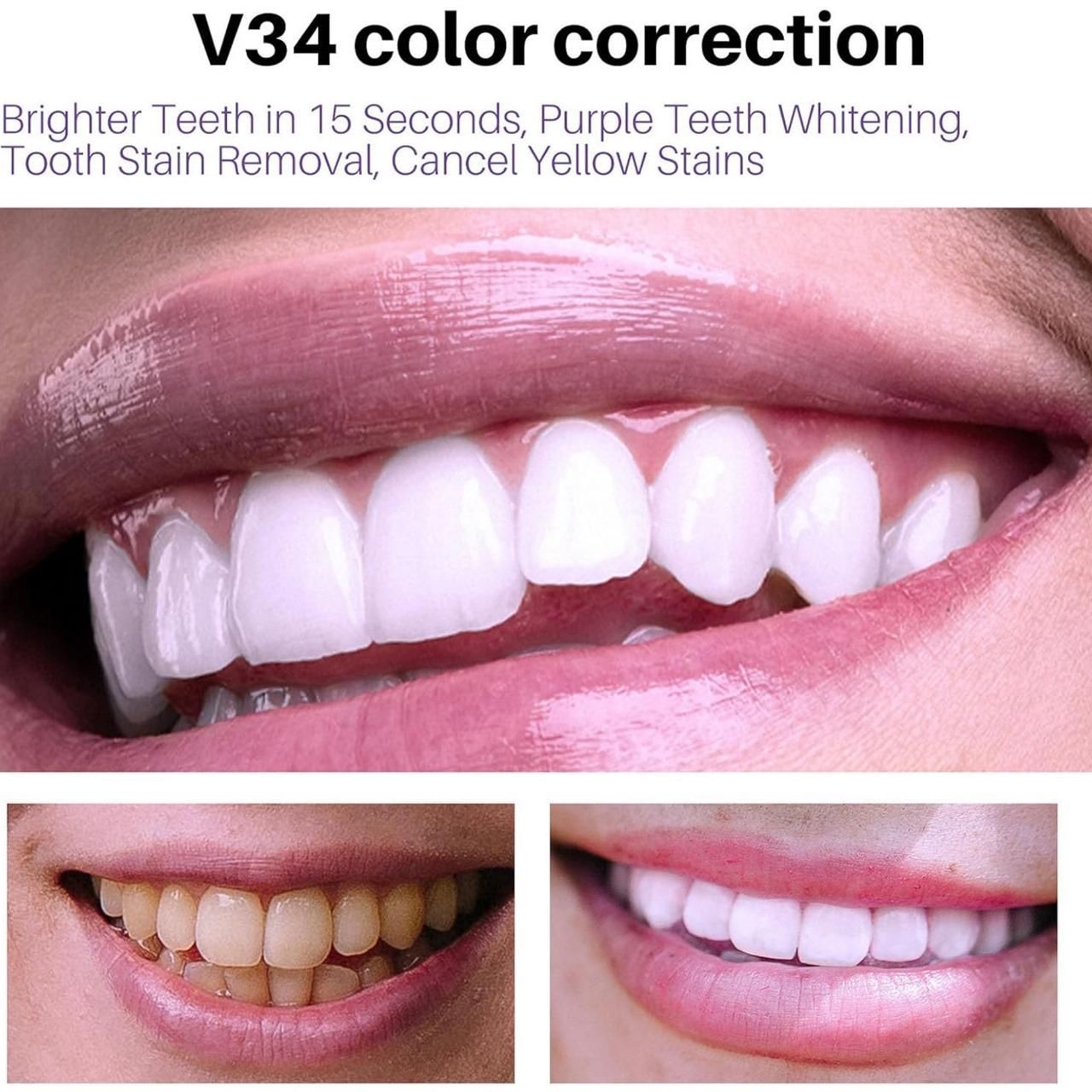 Lanthome V34 Teeth Whitening Spray Mousse – 50ml (Pack of 2) | Removes Stains, Brightens Smile & Reduces Sensitivity