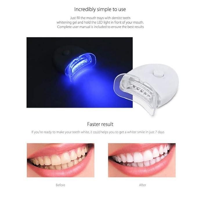 Whitecloud 20-Minute Teeth Cleaning & Whitening Kit – With Vitamin E Gel | Fast, Effective Dental Care at Home (1 Set)